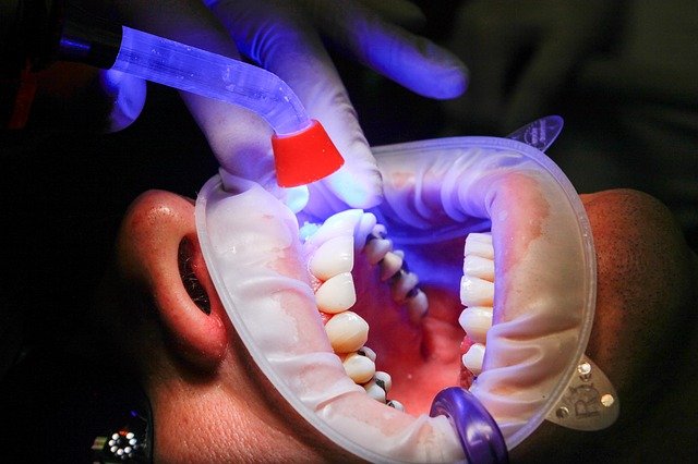 Zobni implantati